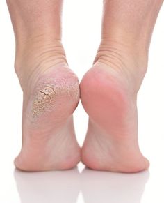 🌟 ¡Dile Hola a unos Pies Suaves y Tersos en Solo 10 Minutos! 👣 - Max Variedad